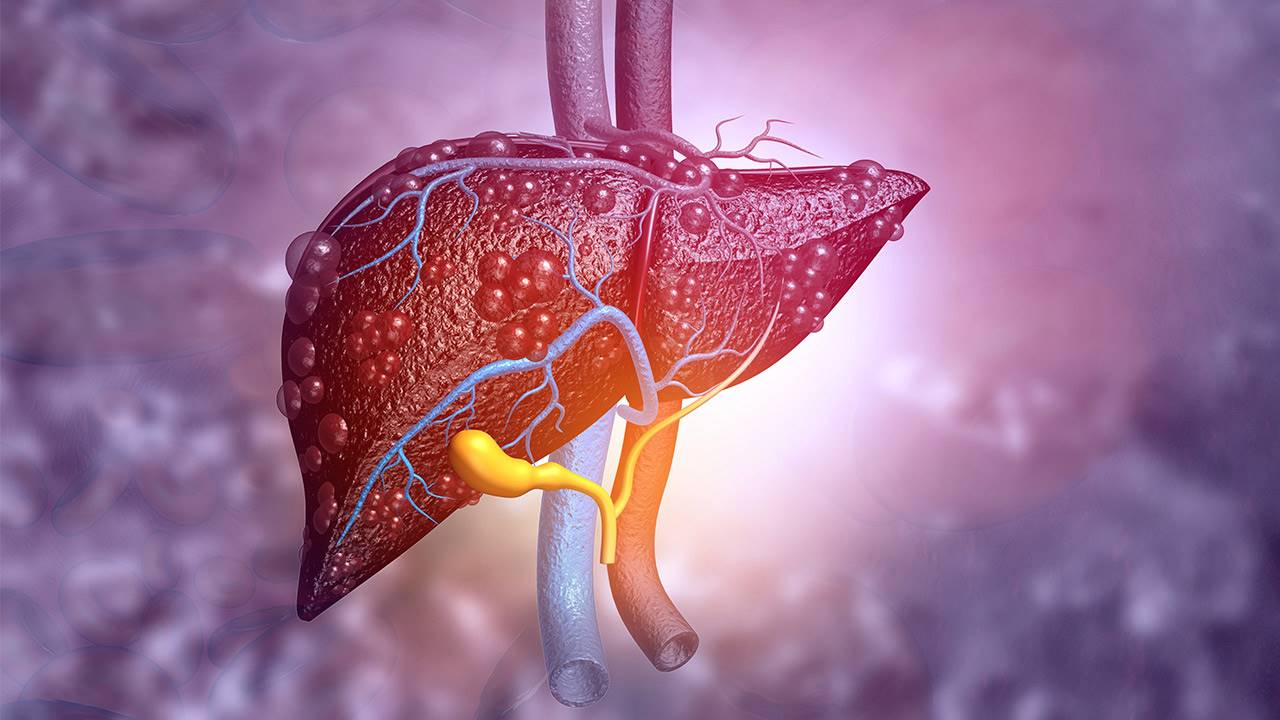 Hepatitis: síntomas, tipos y tratamiento